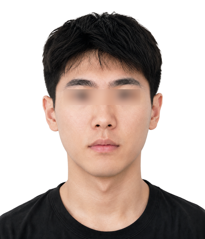 제모 수염 시술 후