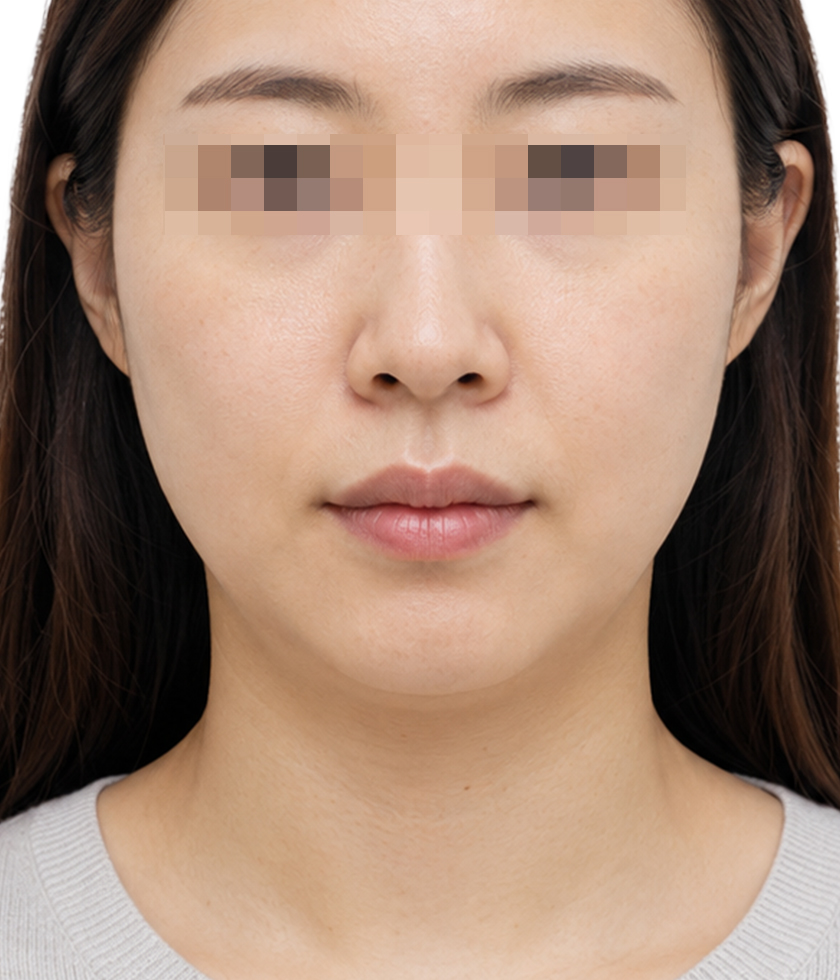 시술 전