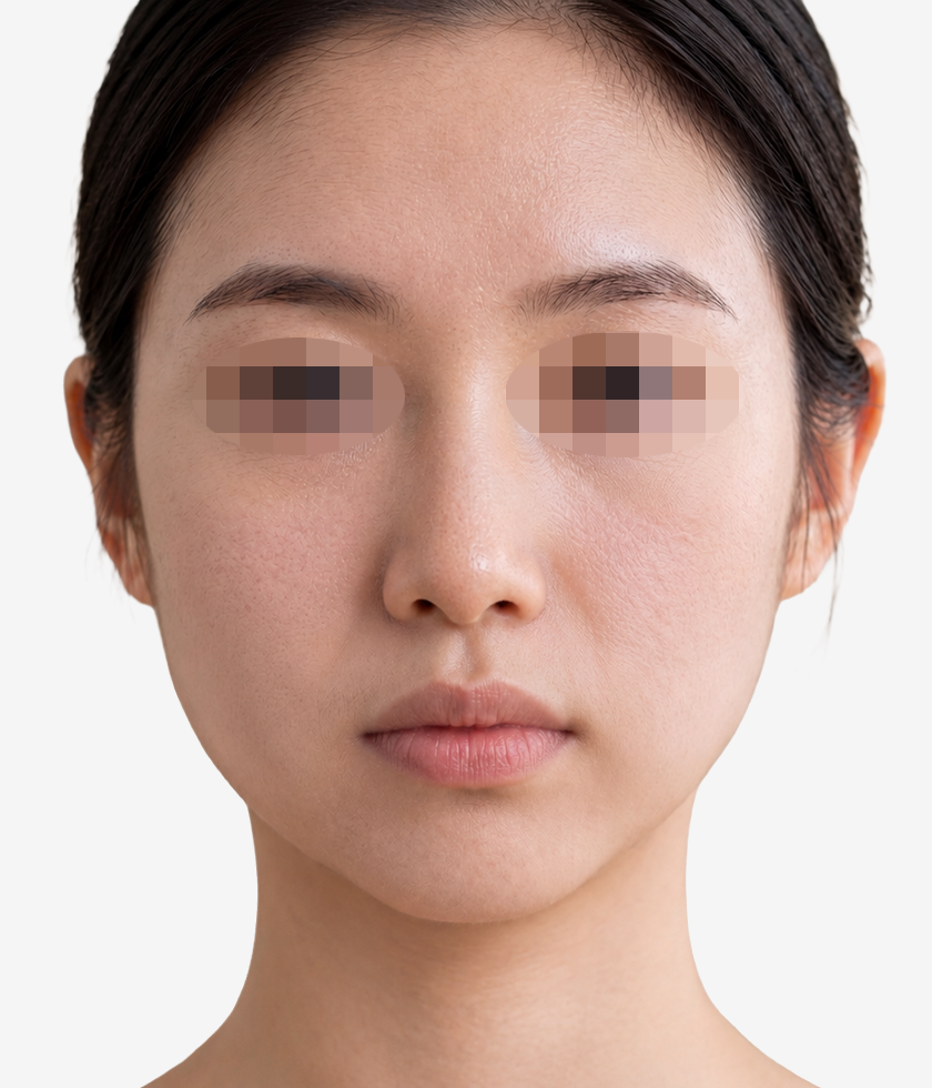 시술 전