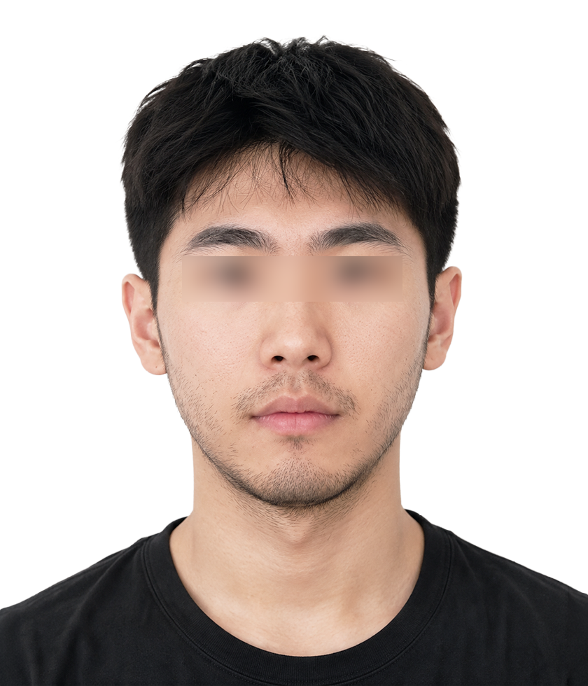 제모 수염 시술 전