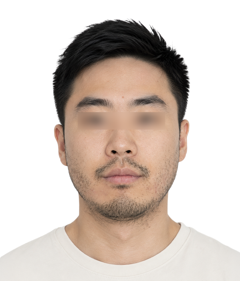 시술 전